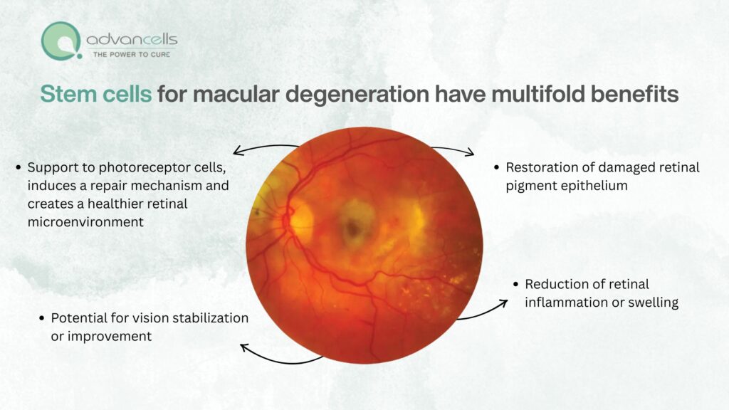 Stem-Cell-Treatment-Works-for-Macular-Degeneration